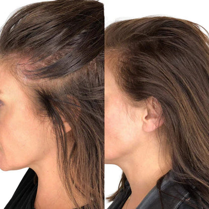 Hair Lumia™ - Brosse Thérapie Lumière Rouge